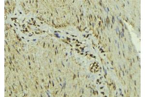 ABIN6277139 at 1/100 staining Mouse muscle tissue by IHC-P. (MAX Antikörper  (N-Term))