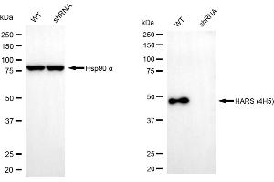 Western blotting analysis using HARS1 antibody (ABIN7798918). (Histidine--tRNA Ligase (HARS-1) Antikörper)