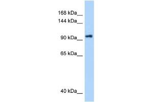 WB Suggested Anti-DHX16 Antibody Titration: 0. (DHX16 Antikörper  (N-Term))