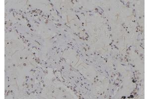ABIN6266174 and ABIN6277206 at 1/100 staining Human lung tissue by IHC-P. (Histone 3 Antikörper  (H3K79me3))