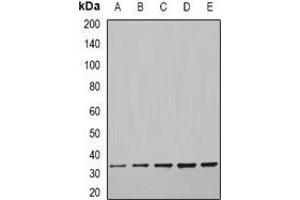 Western blot analysis of CFDP1 expression in MCF7 (A), SKOV3 (B), mouse brain (C), mouse liver (D), rat spleen (E) whole cell lysates. (CFDP1 Antikörper)