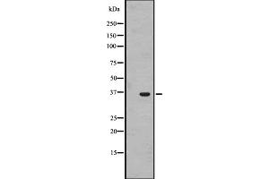 Western blot analysis of OR1J4 expression in HL-60 cell line lysate ;,The lane on the left is treated with the antigen-specific peptide. (OR1J4 Antikörper  (C-Term))