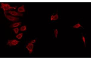 ABIN6274433 staining HeLa by IF/ICC. (ANKK1 Antikörper  (Internal Region))