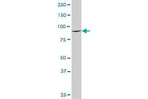DNAJC10 monoclonal antibody (M02A), clone 3A8. (DNAJC10 Antikörper  (AA 688-793))