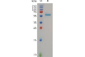 SDS-PAGE (SDS) image for Matrix Metallopeptidase 13 (Collagenase 3) (MMP13) (AA 20-471) protein (His tag) (ABIN7490695)
