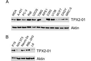 Western blotting analysis of TPX2 using monoclonal antibody TPX2-01 in A) human cell lines, B) murine (P19, NIH 3T3, Neuro-2a) and rat (RBL-2H3, L6) cell lines. (TPX2 Antikörper)