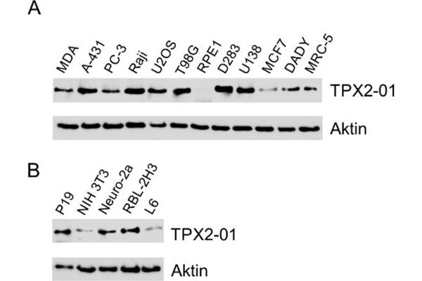 TPX2 anticorps