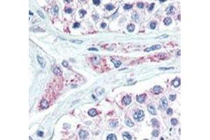 Immunohistochemistry (IHC) image for anti-Lin-28 Homolog B (LIN28B) (AA 1-30) antibody (ABIN3031628)