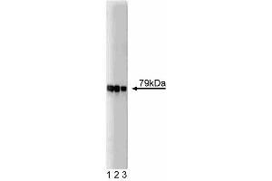 Western blot analysis of AKAP79 on SW13 lysate. (AKAP5 Antikörper  (AA 180-427))