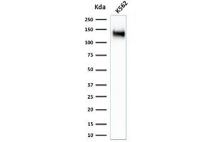 Western Blot Analysis of K562 cell lysate using CD43 Rabbit Recombinant Monoclonal Antibody (SPN/1766R). (Rekombinanter CD43 Antikörper)