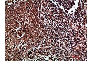 Immunohistochemical analysis of paraffin-embedded human-tonsil, antibody was diluted at 1:200 (CDK6 Antikörper  (AA 280-325))