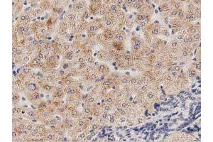 Immunohistochemical staining of paraffin-embedded Human bladder tissue using anti-PECR mouse monoclonal antibody. (PECR Antikörper)