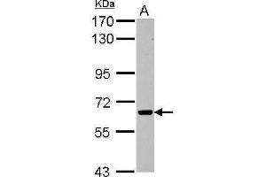 WB Image Sample (30 ug of whole cell lysate) A: HepG2 7. (ACVR1C/ALK7 Antikörper  (Center))