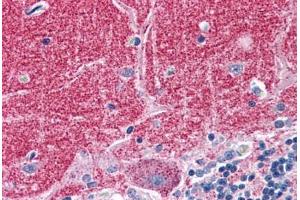 Human Brain, Cerebellum: Formalin-Fixed, Paraffin-Embedded (FFPE) (Septin 3 Antikörper  (AA 15-26))