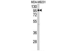 Western blot analysis of BAHD1 Antibody (C-term) in MDA-MB231 cell line lysates (35µg/lane). (BAHD1 Antikörper  (C-Term))
