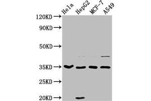 Western Blot Positive WB detected in: Hela whole cell lysate, HepG2 whole cell lysate, MCF-7 whole cell lysate, A549 whole cell lysate All lanes: AIMP1 antibody at 3. (AIMP1 Antikörper  (AA 25-180))