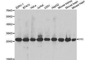 Western blot analysis of extracts of various cell lines, using TPI1 antibody. (TPI1 Antikörper)