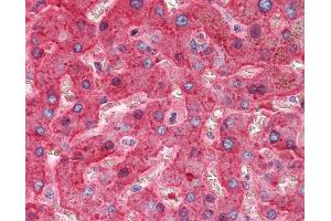 Immunohistochemistry (IHC) image for anti-Serpin Peptidase Inhibitor, Clade G (C1 Inhibitor), Member 1 (SERPING1) antibody (ABIN574166)