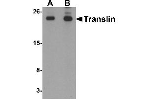 Western blot analysis of Translin in rat lung tissue lysate with Translin antibody at (A) 0. (Translin Antikörper  (C-Term))