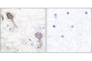 Immunohistochemistry analysis of paraffin-embedded human brain tissue, using Parkin Antibody.