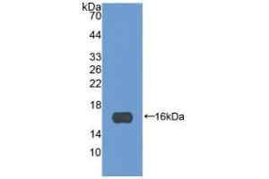 Western Blotting (WB) image for Periostin (POSTN) ELISA Kit (ABIN6574325)