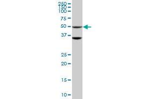 Western Blotting (WB) image for anti-serine/threonine Kinase 40 (STK40) (AA 349-435) antibody (ABIN599597) (STK40 Antikörper  (AA 349-435))