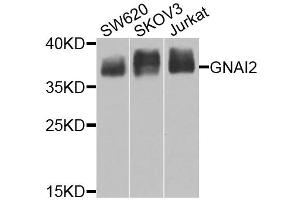 Western blot analysis of extracts of various cell lines, using GNAI2 antibody (ABIN6291411) at 1:1000 dilution. (GNAI2 Antikörper)