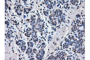 Immunohistochemical staining of paraffin-embedded breast tissue using anti-ATP5B mouse monoclonal antibody. (ATP5B Antikörper)
