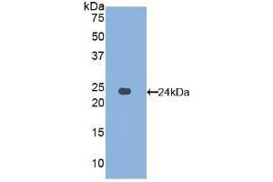 Detection of Recombinant AFM, Human using Polyclonal Antibody to Afamin (AFM) (Afamin Antikörper  (AA 211-403))