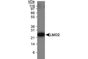 Western Blot Analysis of LMO2 in Ramos cell lysate using LMO2 monoclonal antibody, clone 1A9-3B11 .