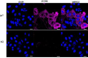 Immunocytochemical staining of HepG2 cells using EGFR antibody (ABIN7798480), 1:1,000), Top panel: wild-type (WT), Bottom panal: Adiponectin receptor 1 shRNA knockdown (KD).