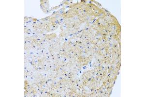 Immunohistochemistry of paraffin-embedded mouse heart using STC1 antibody (ABIN5975425) at dilution of 1/100 (40x lens). (Stanniocalcin 1 Antikörper)