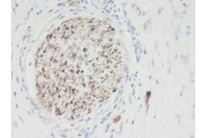 Image no. 1 for anti-Galectin 3 (LGALS3) antibody (ABIN464873) (Galectin 3 Antikörper)