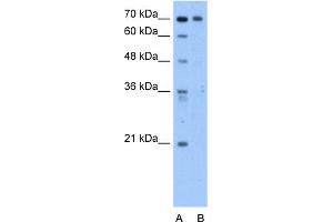 WB Suggested Anti-C9orf96 Antibody Titration:  2. (C9orf96 Antikörper  (C-Term))