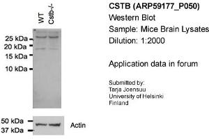 Western Blotting (WB) image for anti-Cystatin B (Stefin B) (CSTB) (N-Term) antibody (ABIN2787965) (CSTB Antikörper  (N-Term))