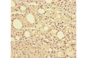 Immunohistochemistry of paraffin-embedded human adrenal gland tissue using ABIN7148417 at dilution of 1:100 (NDUFAF1 Antikörper  (AA 25-327))
