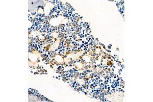 Immunohistochemistry of paraffin embedded mouse bone using CSF1 (ABIN7073553) at dilution of 1:450 (400x lens) (M-CSF/CSF1 Antikörper)
