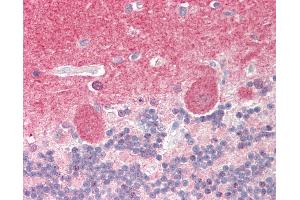 Immunohistochemistry (IHC) image for anti-Protein Phosphatase 3, Catalytic Subunit, alpha Isoform (PPP3CA) (AA 432-481) antibody (ABIN6755321)