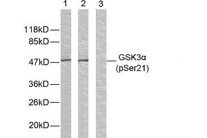 Western blot analysis of extracts from ovary cancer cells using GSK3α (phospho-Ser21) antibody (E011007). (GSK3 alpha Antikörper  (pSer21))