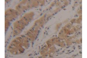 DAB staining on IHC-P; Samples: Human Stomach Tissue (SUOX Antikörper  (AA 80-545))