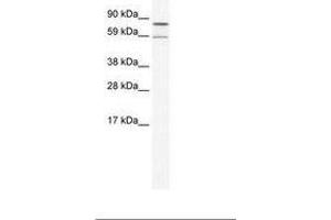 Image no. 1 for anti-Poly A Specific Ribonuclease (PARN) (N-Term) antibody (ABIN202834) (PARN Antikörper  (N-Term))