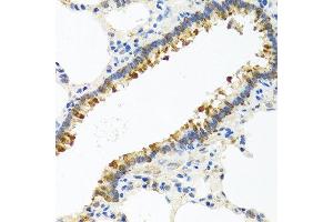 Immunohistochemistry of paraffin-embedded rat lung using CST4 antibody at dilution of 1:100 (40x lens). (CST4 Antikörper)
