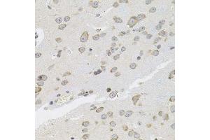 Immunohistochemistry of paraffin-embedded mouse brain using VEPH1 antibody. (VEPH1 Antikörper  (AA 448-547))