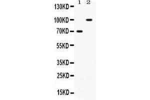 Western blot analysis of ZP1 expression in rat ovary extract ( Lane 1) and SKOV3 whole cell lysates ( Lane 2). (ZP1 Antikörper  (N-Term))