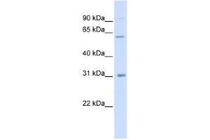 CHST2 antibody used at 1 ug/ml to detect target protein.
