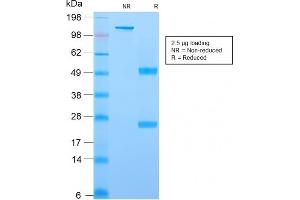 SDS-PAGE Analysis Purified YBX1 Mouse Recombinant Monoclonal Antibody (rYBX1/2430). (Rekombinanter YBX1 Antikörper)