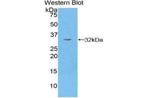 Western blot analysis of recombinant Human PAK4.