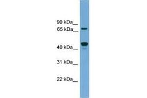 Image no. 1 for anti-Zinc Finger Protein 496 (ZNF496) (AA 411-460) antibody (ABIN6744635) (ZNF496 Antikörper  (AA 411-460))