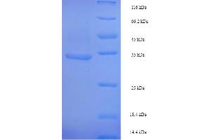 SDS-PAGE (SDS) image for Crossover Junction Endodeoxyribonuclease RuvC (RuvC) (AA 2-173) protein (His-SUMO Tag) (ABIN5711111) (RuvC Protein (AA 2-173) (His-SUMO Tag))