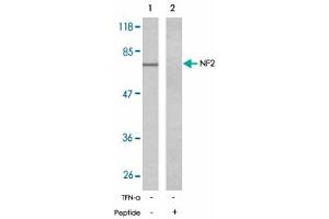 Western blot analysis of extracts from 293 cells untreated or treated with IFN-alpha (100 ng/mL, 15 min) using NF2 polyclonal antibody . (Merlin Antikörper)